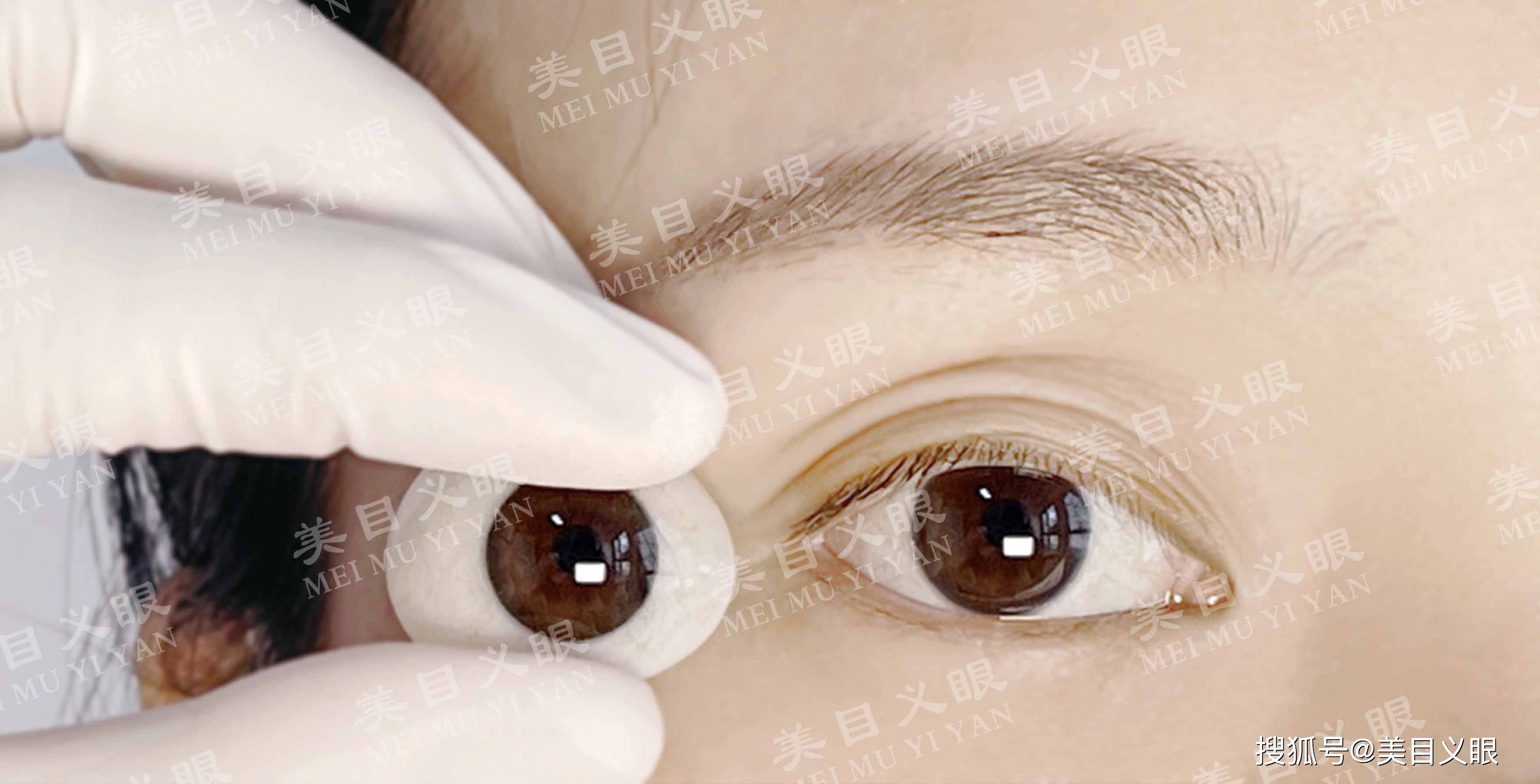 定制义眼,20年义眼师经验之谈_进口_问题_效果