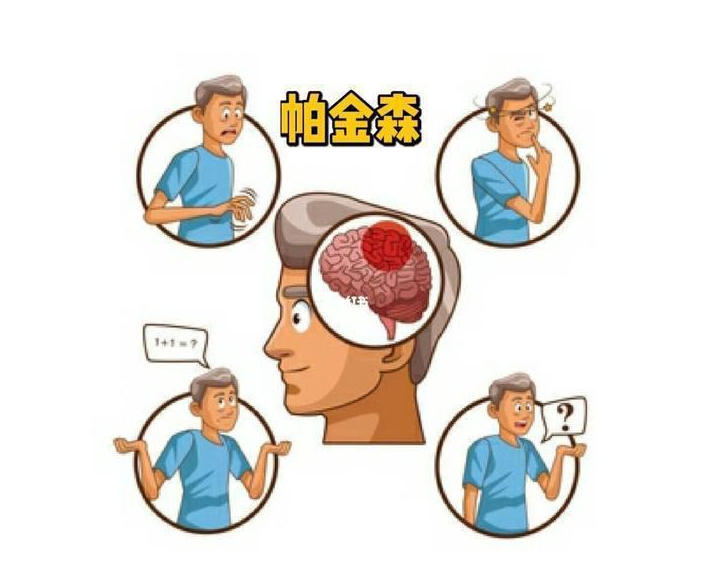 帕金森病人中期过渡到晚期多久_患者_治疗_症状
