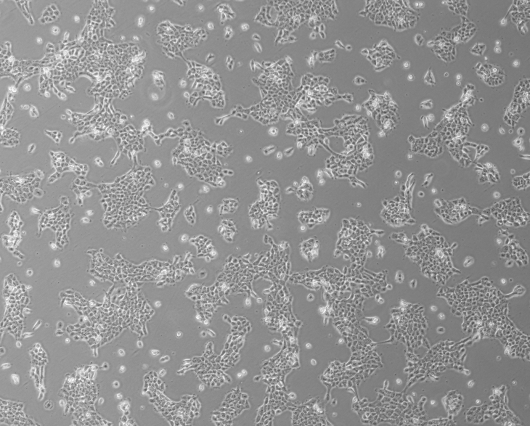 a-431(人表皮癌细胞)培养攻略_研究_时间较长_条件