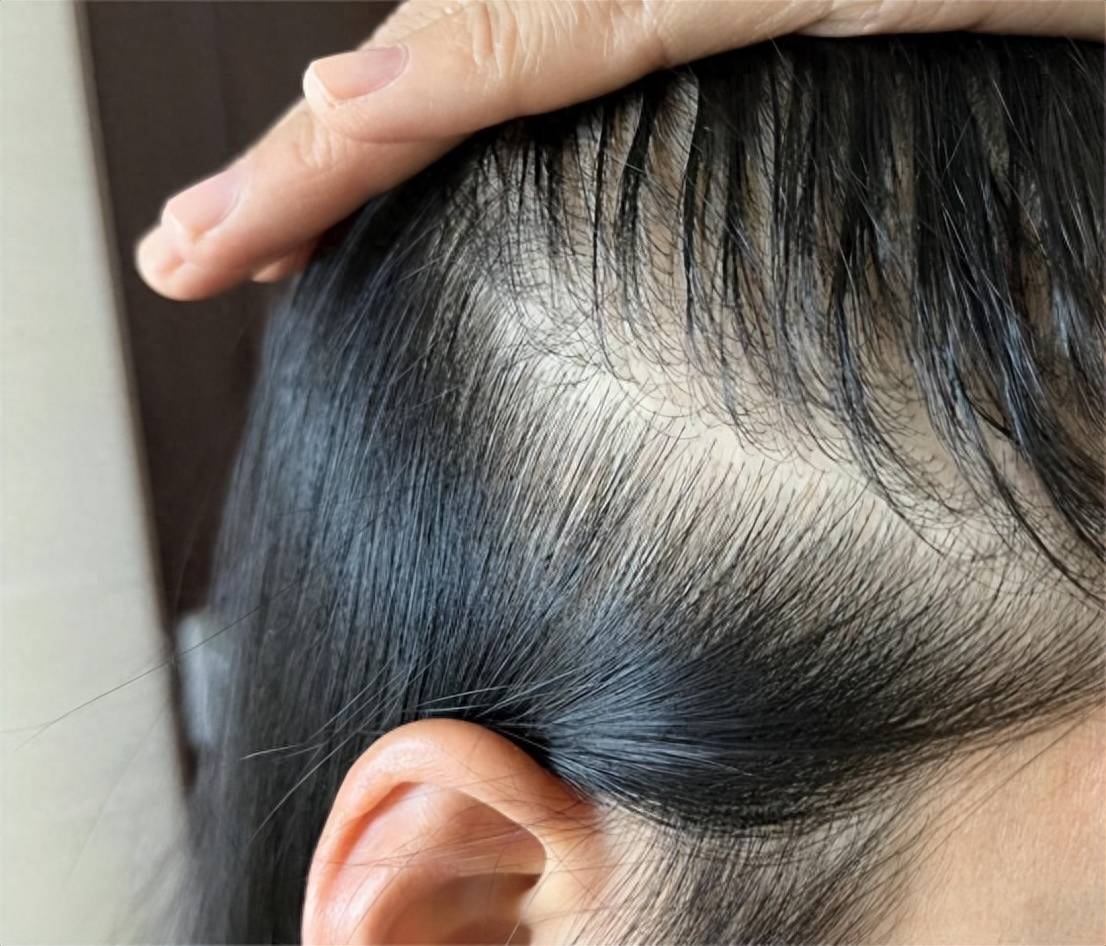 头发_营养_时候