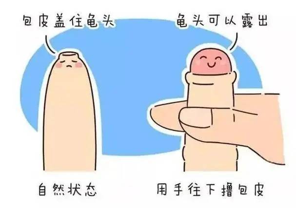 丁丁是什么露出图片