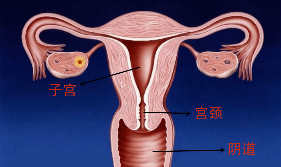 卵巢综合症可以自愈吗? 该怎么做?