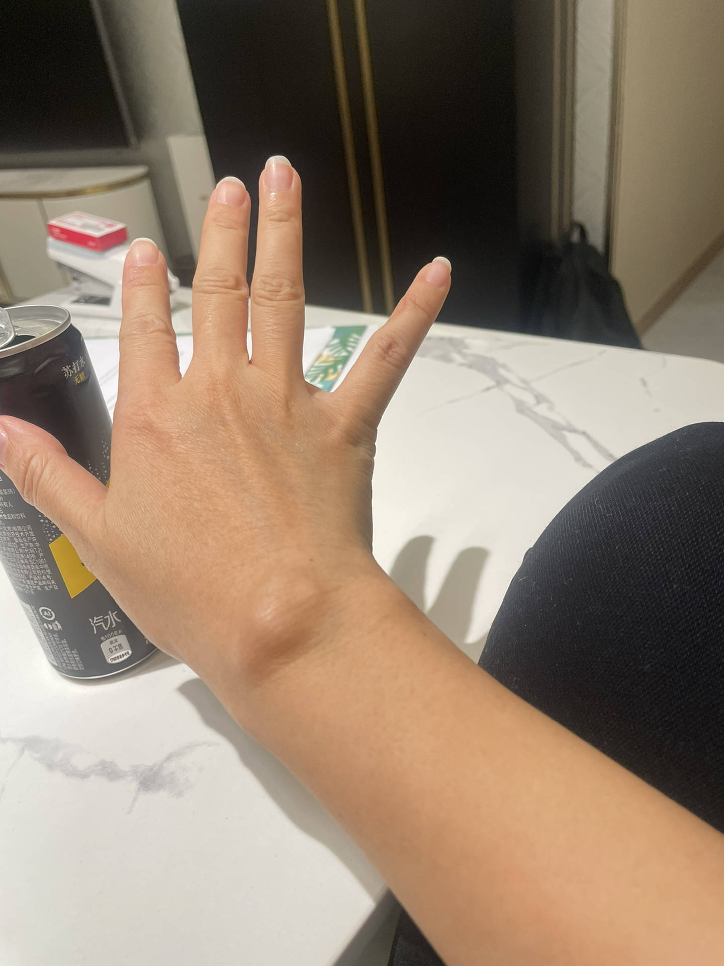 谁能懂啊,困扰我已久的的腱鞘炎居然这么容易就解决了?