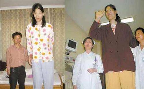 原创比姚明还高的湖南女孩患上巨人症18岁去世遗体37年未火化