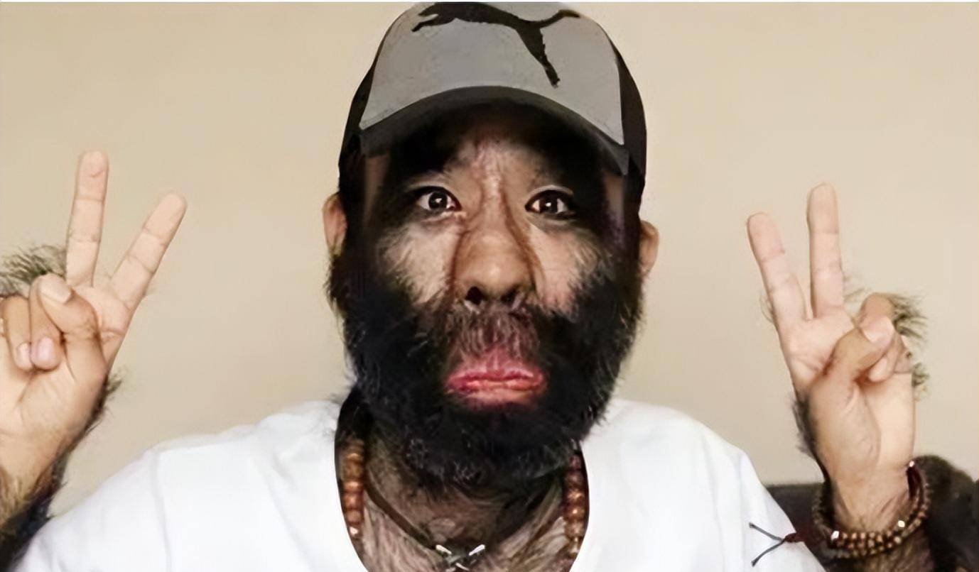 当年轰动一时的"毛孩":42岁娶90后娇妻,生下一子未遗传长毛