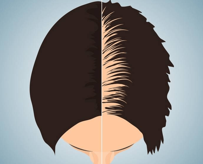 头发