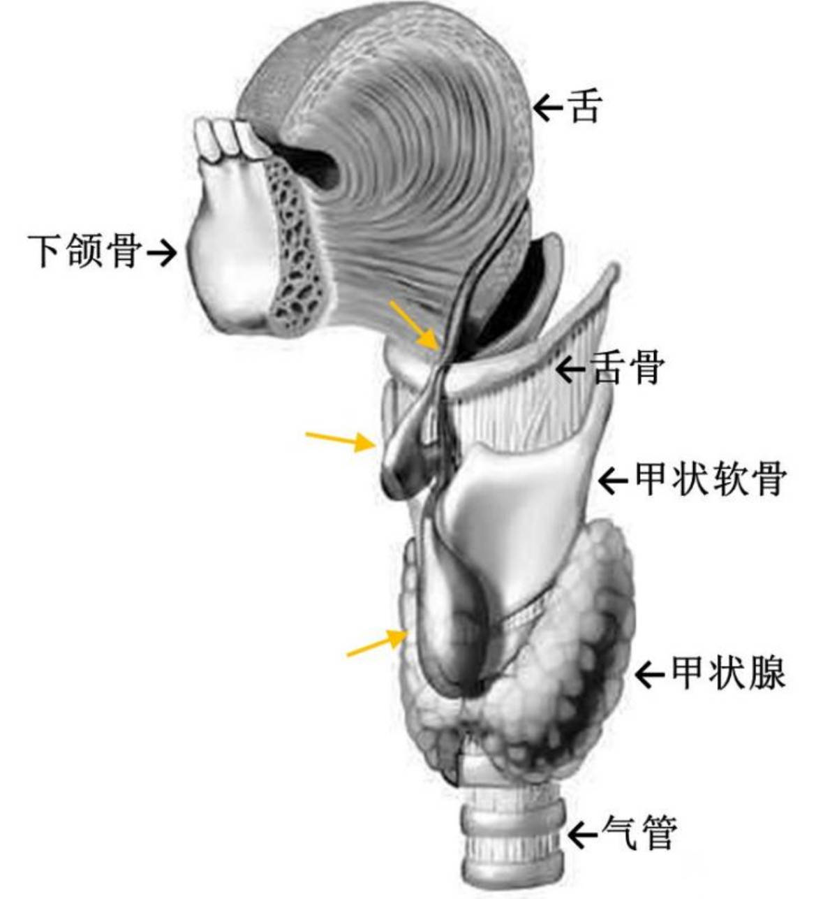 甲状舌管囊肿解剖位置图片