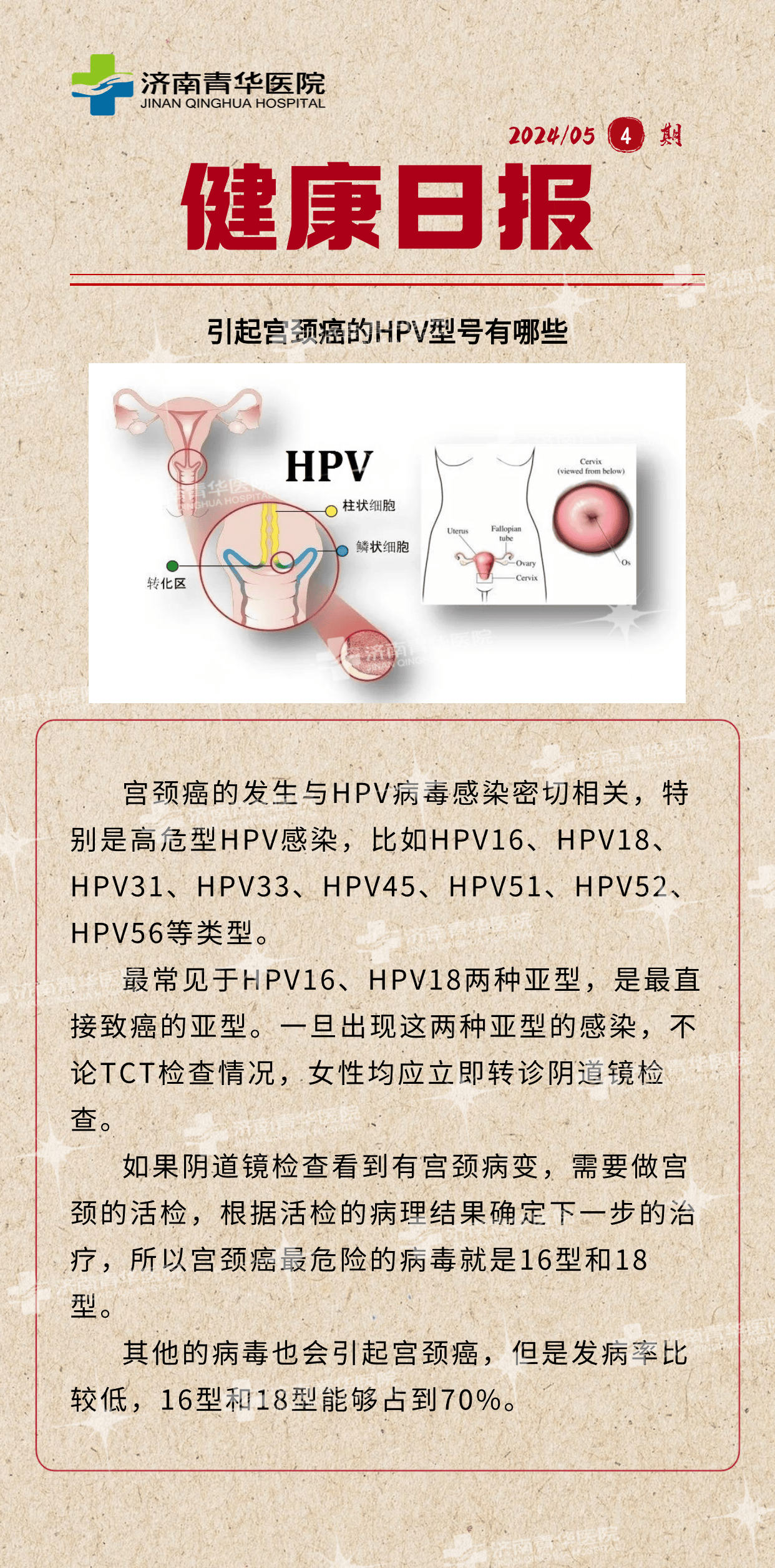引起宫颈癌的hpv型号有哪些呢?