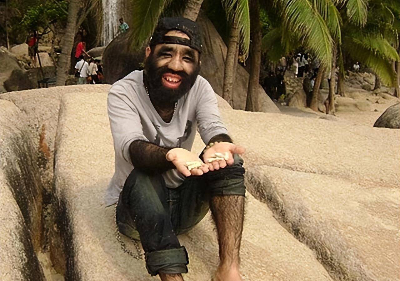 当年轰动一时的"毛孩":42岁娶90后娇妻,生下一子未遗传长毛