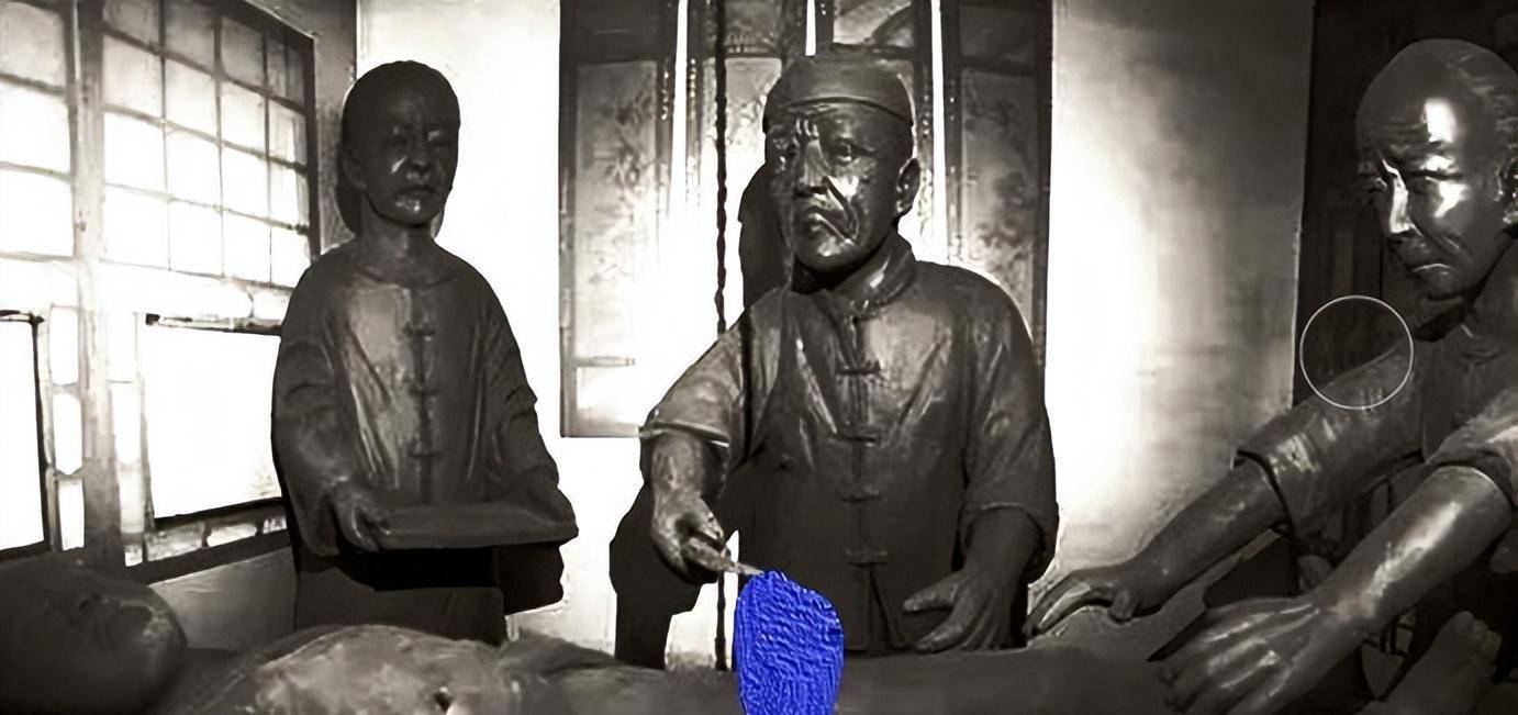 大清"净身"操作官方指南-太监入职的第一关