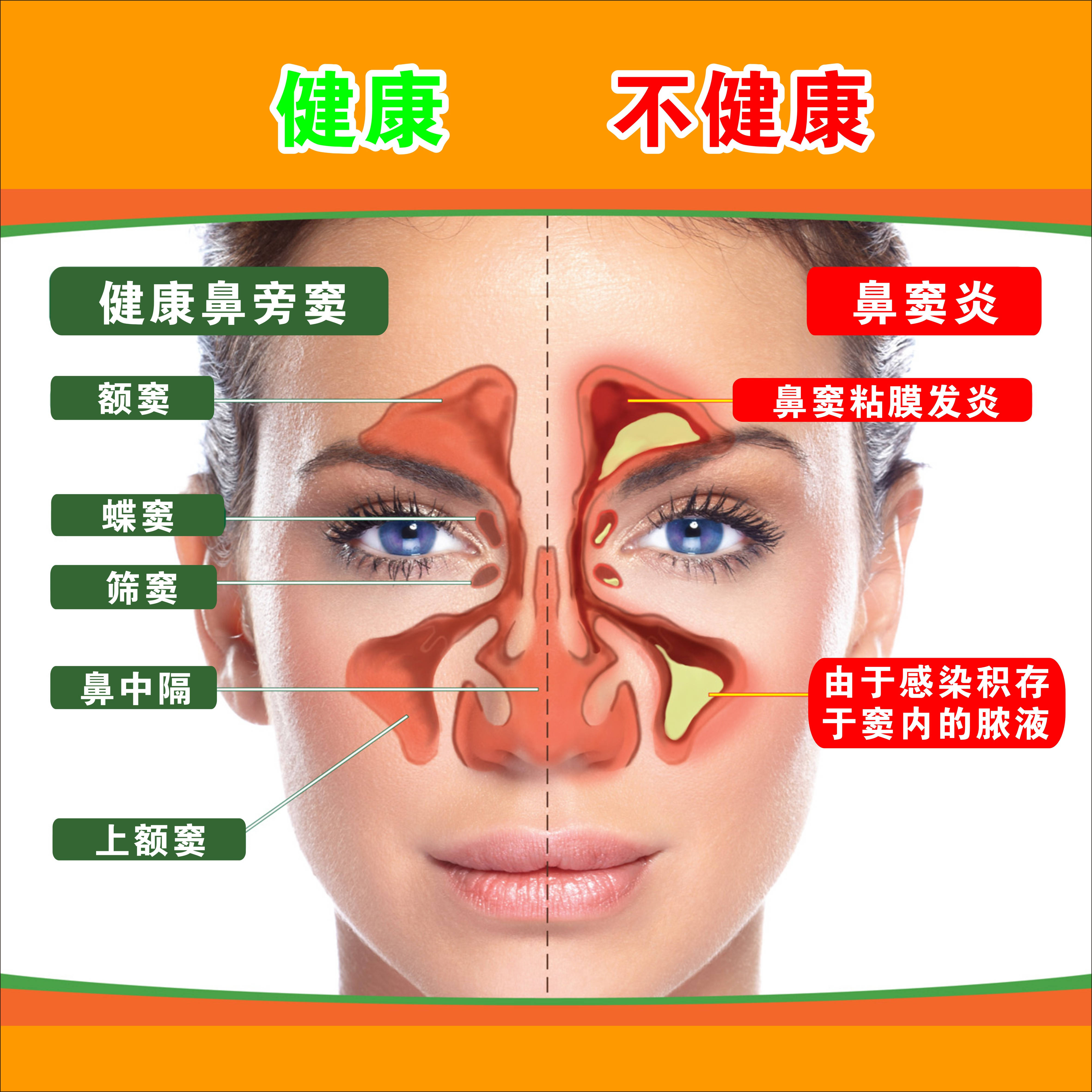 鼻郎中治疗鼻炎(专家教你有效解决鼻炎的方法)