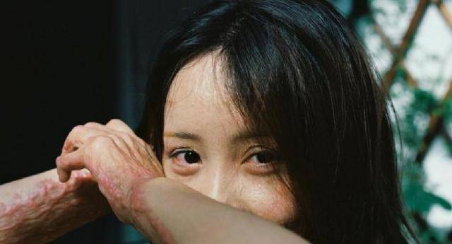 安徽16岁少女周岩,因拒绝官二代被泼汽油毁容,如今过得还好吗?