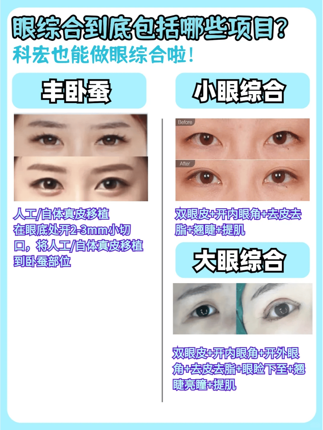 眼综合包括哪些项目?科宏也能做眼综合啦?