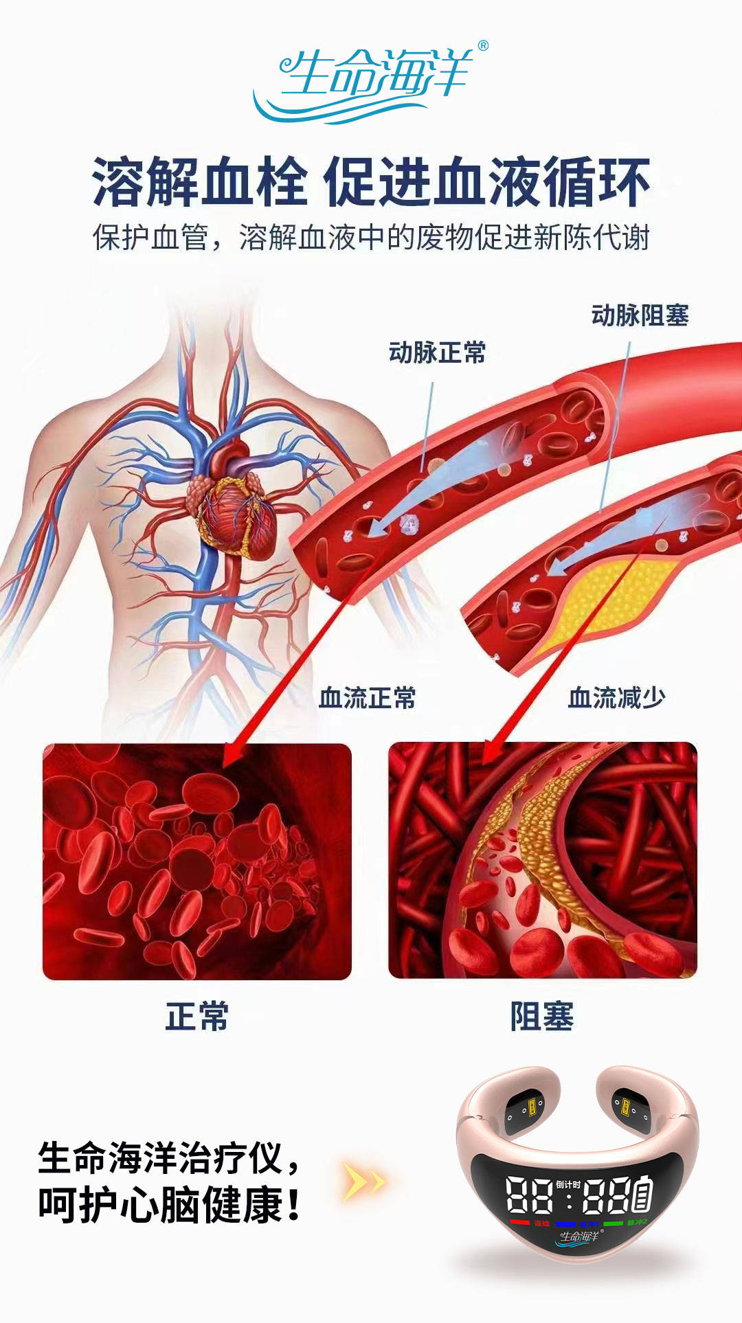 生命海洋治疗仪│出现这三种情况,说明你血管变硬了!