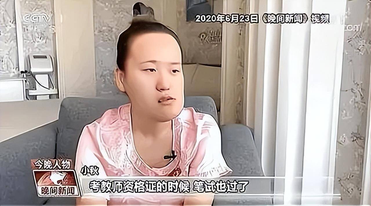 回顾歪脸女孩:年少父母双亡,整形后拒百万年薪只为初心,今怎样_赵宏