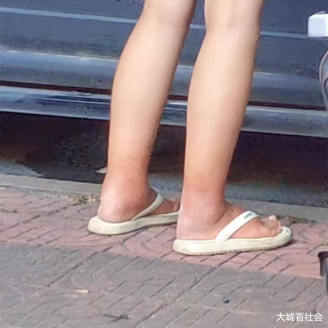 广东:女子几天没换衣服,脚肿走路一瘸一拐,疑似精神失常睡路边