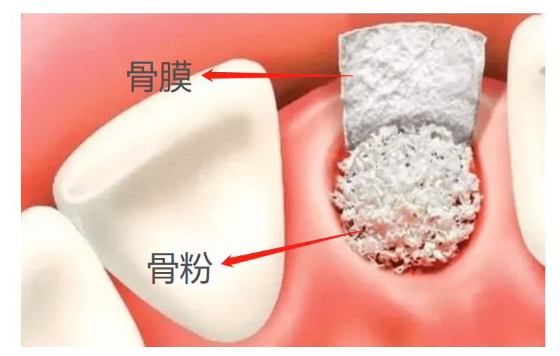 牙床露出白色骨头图片