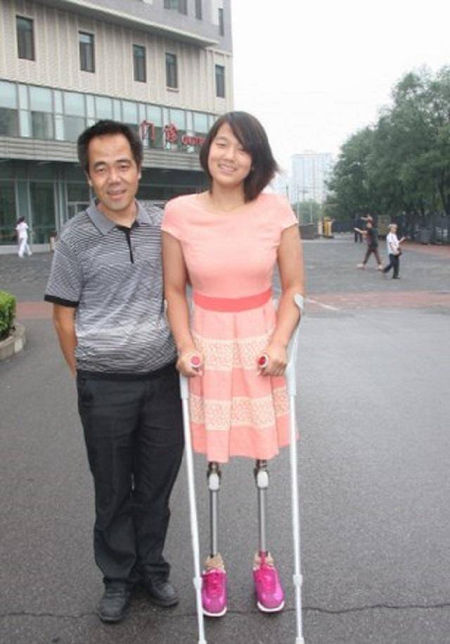 靠半截身躯获游泳冠军,如今装上假肢亭亭玉立_钱红艳_因为_训练