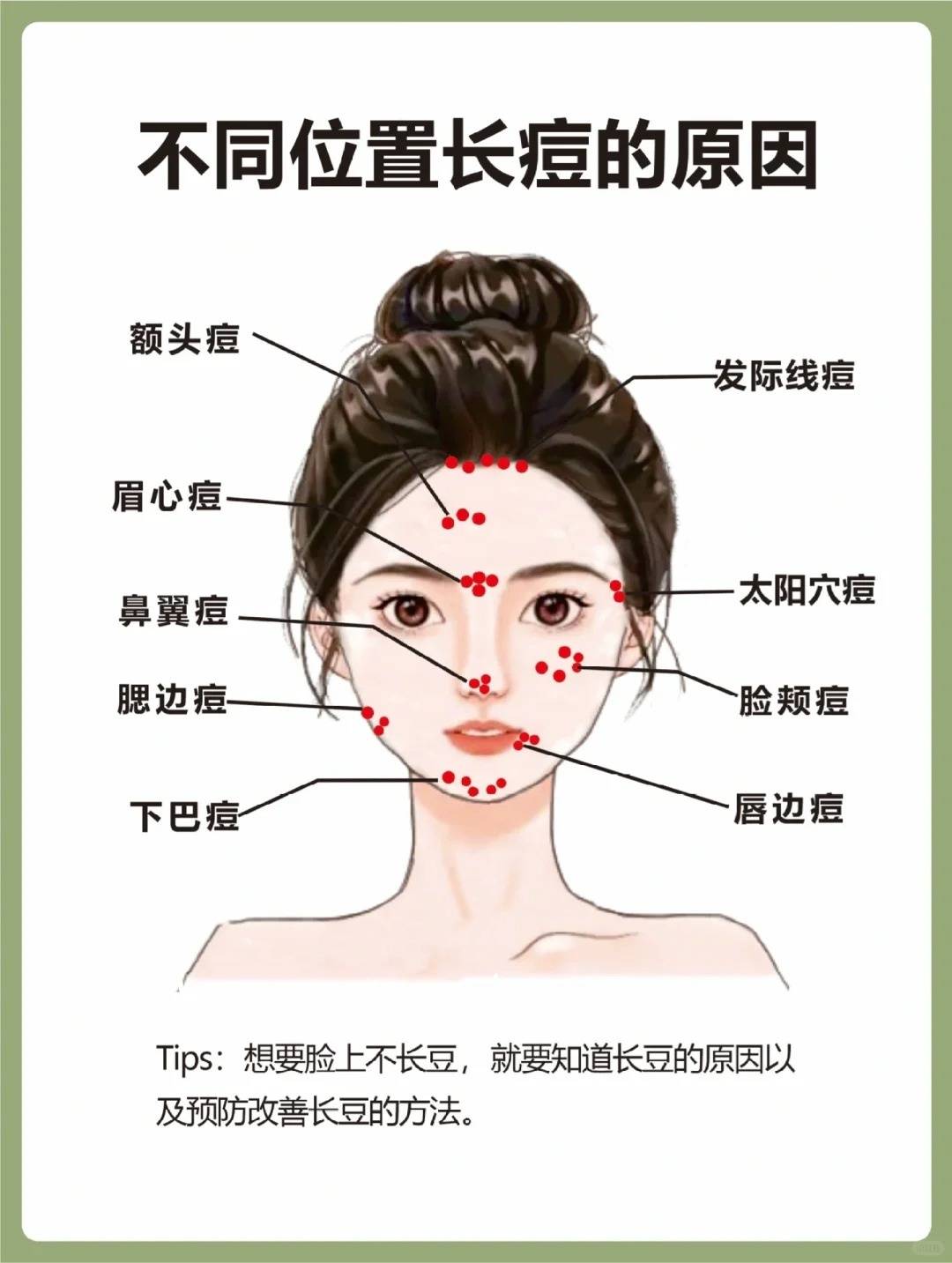 脸部痘痘分布图图片