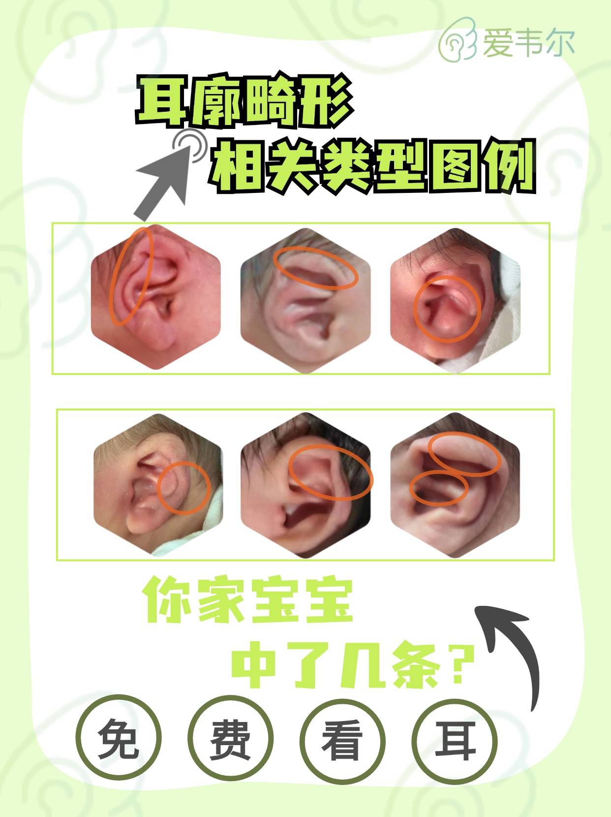 耳廓畸形应该知道的n件事