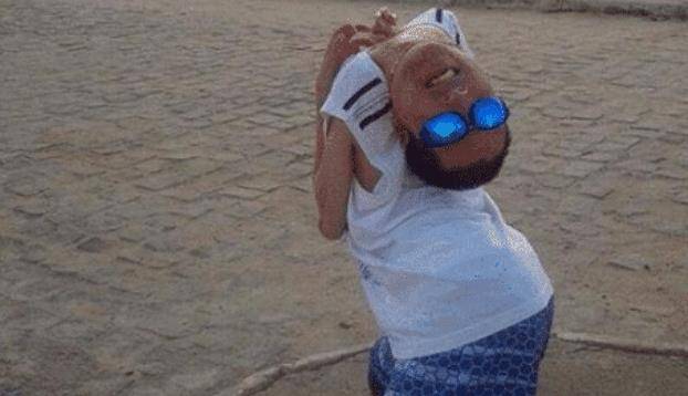 一个世界上,比如说今天所为大家介绍的一位头部弯曲180度的天生畸形者