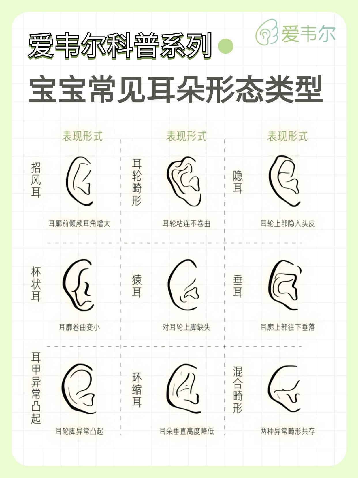 耳朵的类型 种类图片