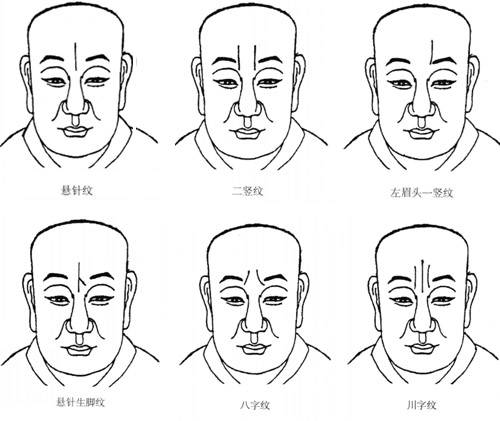 印堂凹陷面相图解图片