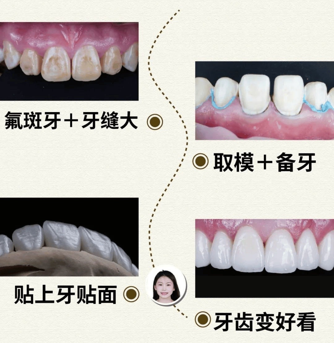 牙齿_治疗_颜色