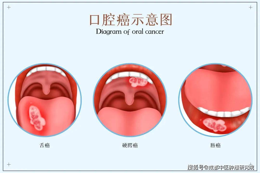 舌尖腺图片