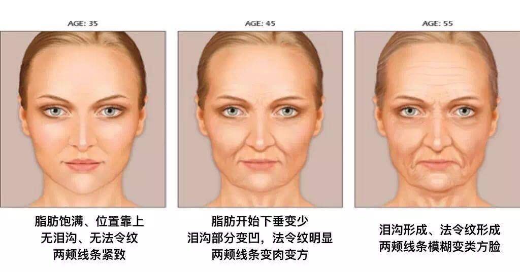 皮肤微整医生臧萌:如何应对面部凹陷造成的显老显疲态问题?_脂肪_影响_面颊