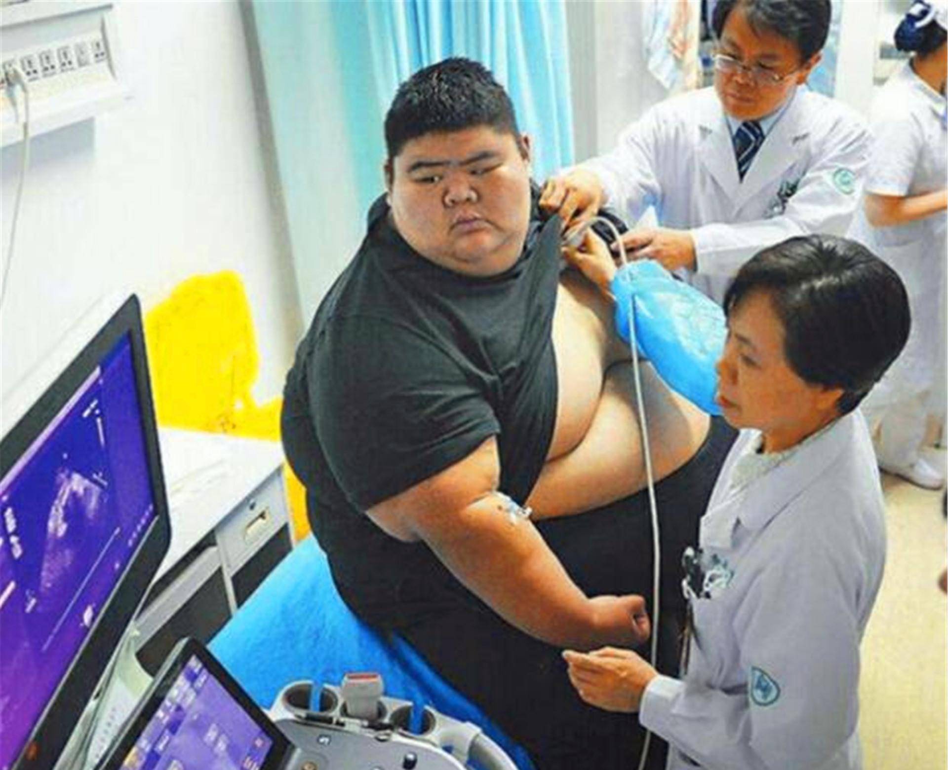 "中国第一胖"王浩楠:小学毕业已300斤,一年减363斤并收获爱情