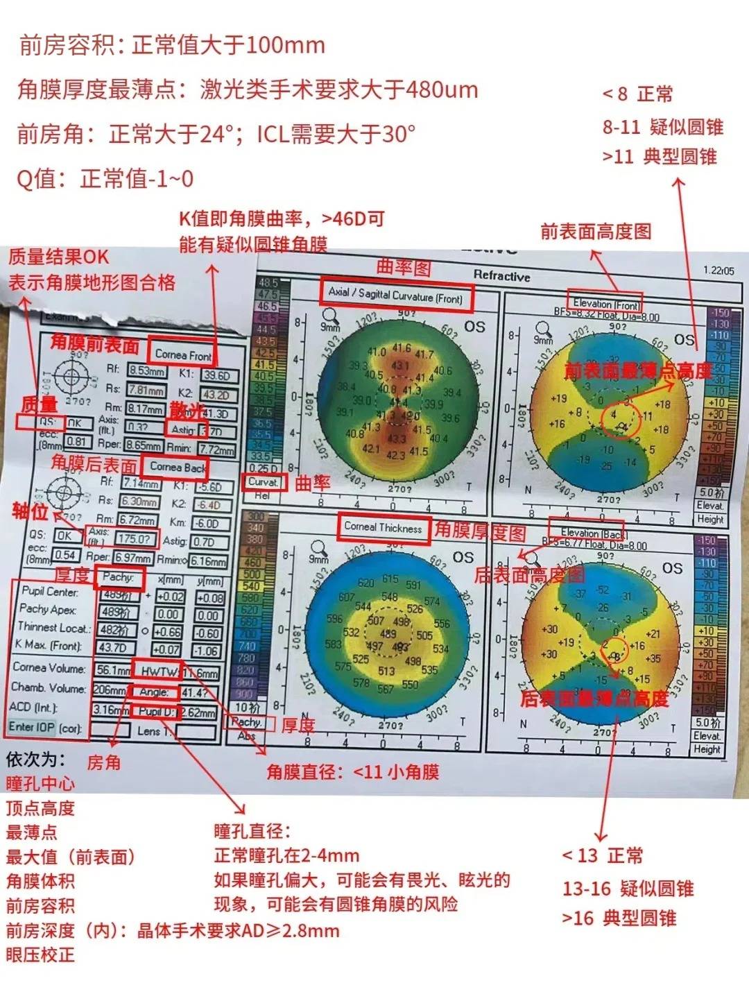 不求人,角膜地形图一看就懂!