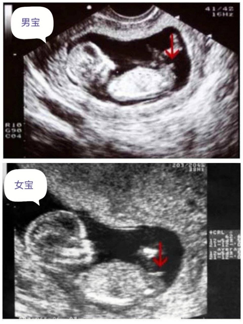 nt图弯着就是男孩!这些nt看男女诀窍建议收藏