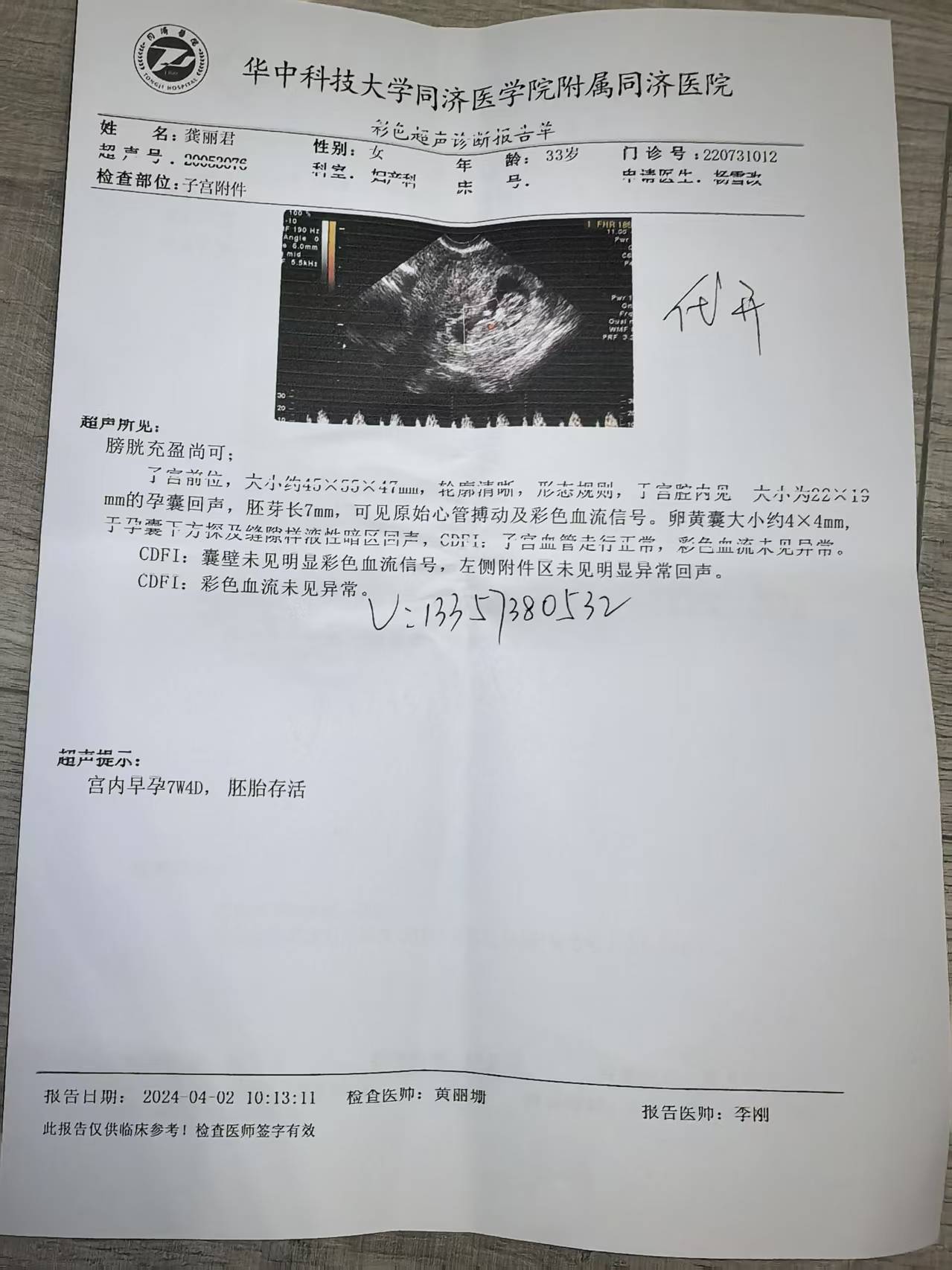 一键生成假怀孕b超单