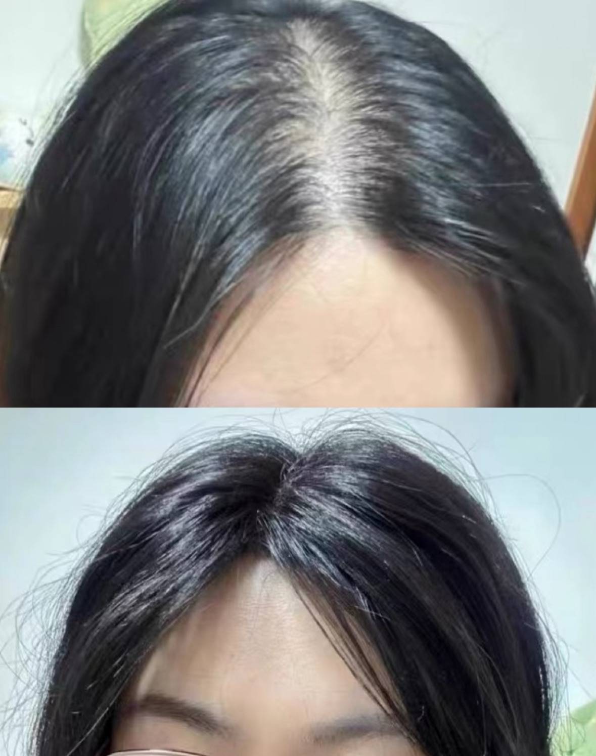 生发液什么牌子最有效果?排名第一的防脱生发产品超高评分