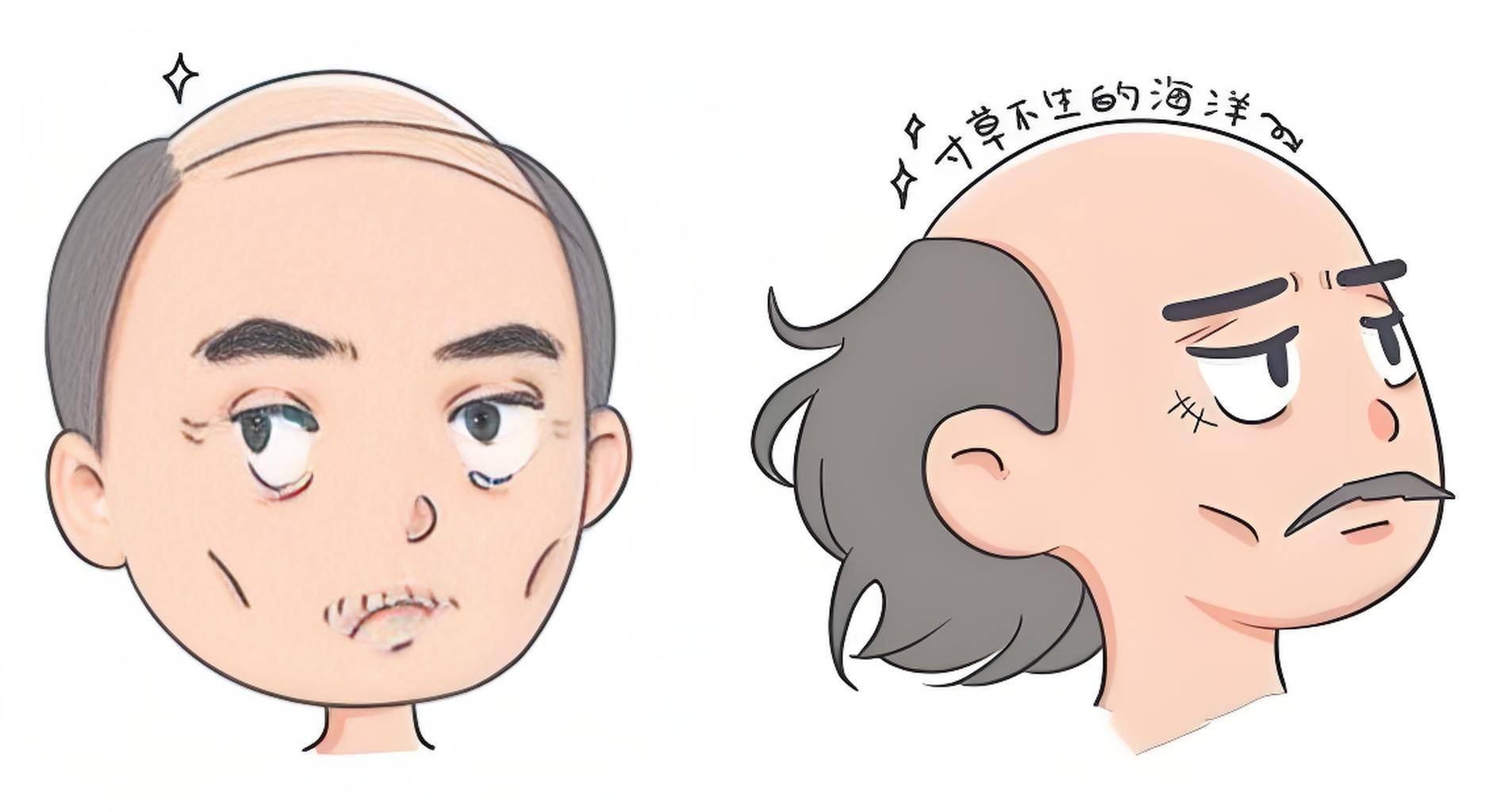 为什么很少看见女性"地中海"脱发?