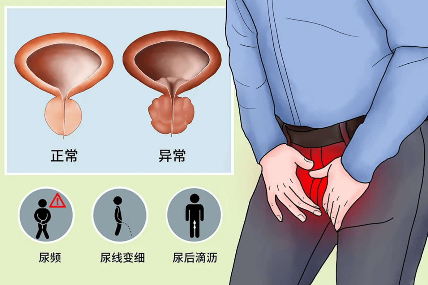 慢性前列腺炎折磨男同胞，治疗观点对立，坚持用药终现转机