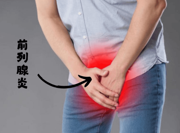 成年男性超半数受前列腺炎困扰，治疗困境何解？国外草本组合成转机