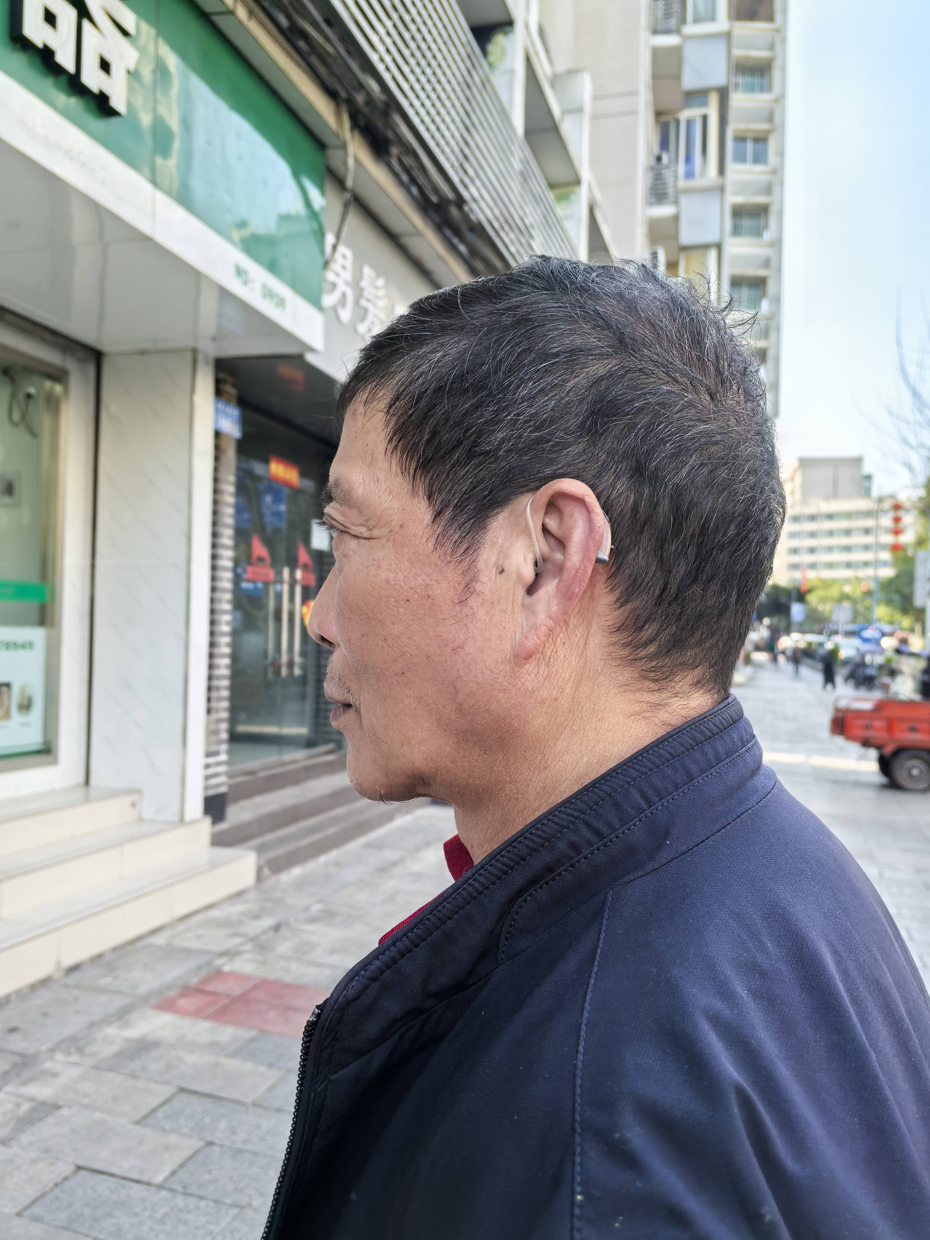 慢性中耳炎鼓膜穿孔人群选助听器