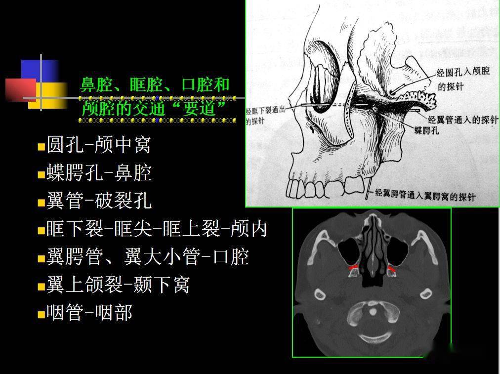 人體鼻咽部及ct的詳細解剖圖分析_全網_影像_淋巴