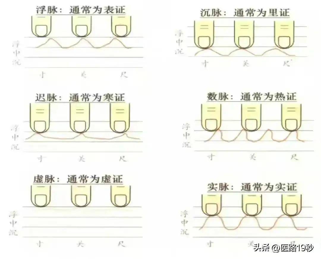 生男生女的脉象图解图片