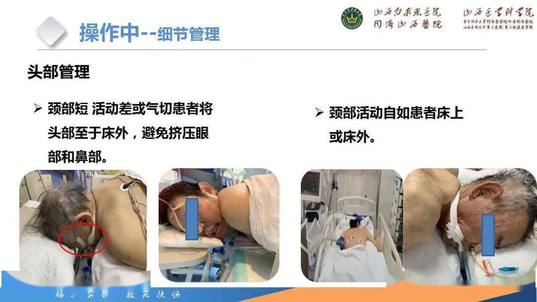 【ppt】俯臥位治療患者壓力性損傷的預防_護理_管理_臨床