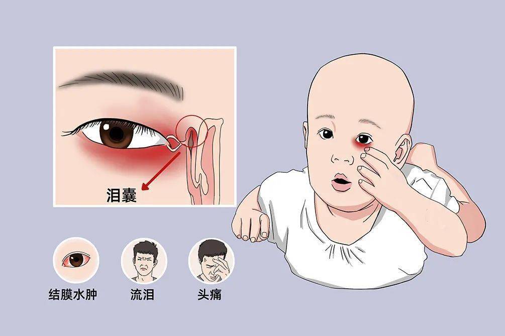 为什么眼睛总流眼泪?别大意,可能是这些原因!_泪液_眼球_防控