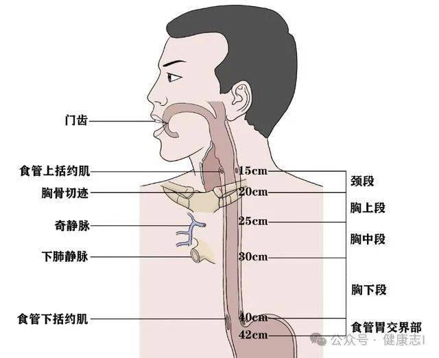 食道癌死前一天症状图图片