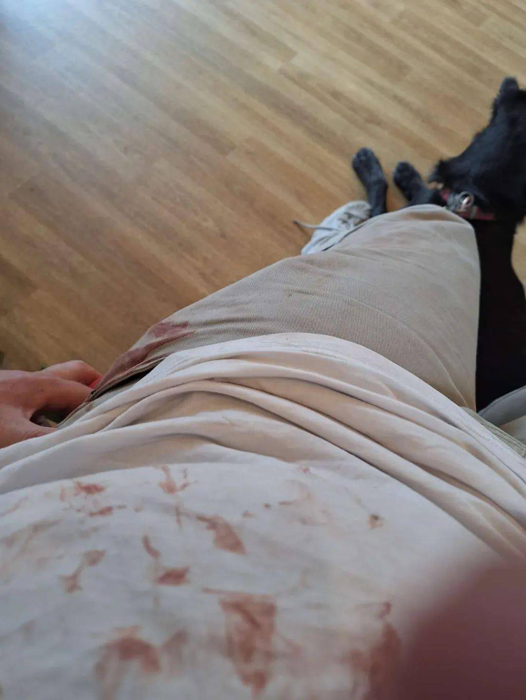 新西兰华人爆料：老公出门遭恶犬无故撕咬，鲜血淋漓！至今找不到狗和主人......