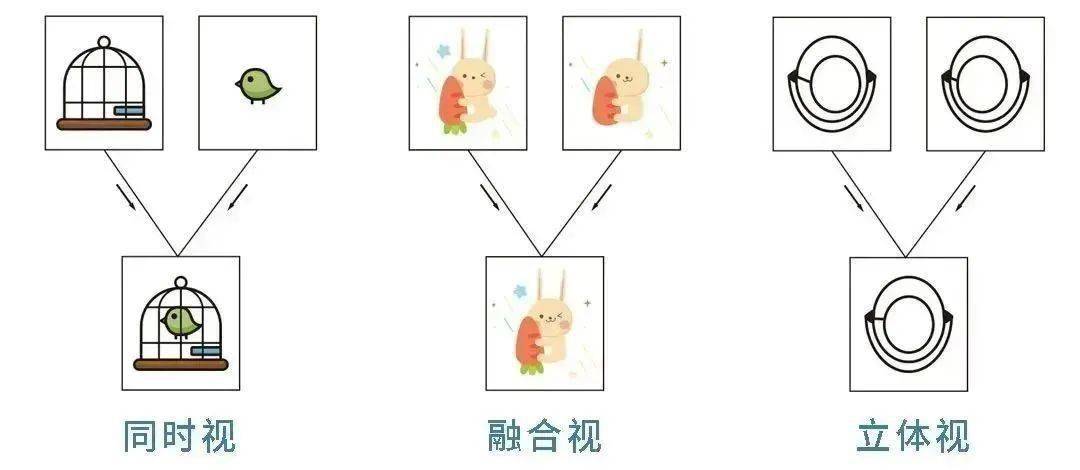 76眼睛的三级视功能02双眼视功能可分为三级:同时视,融合视,立体视.