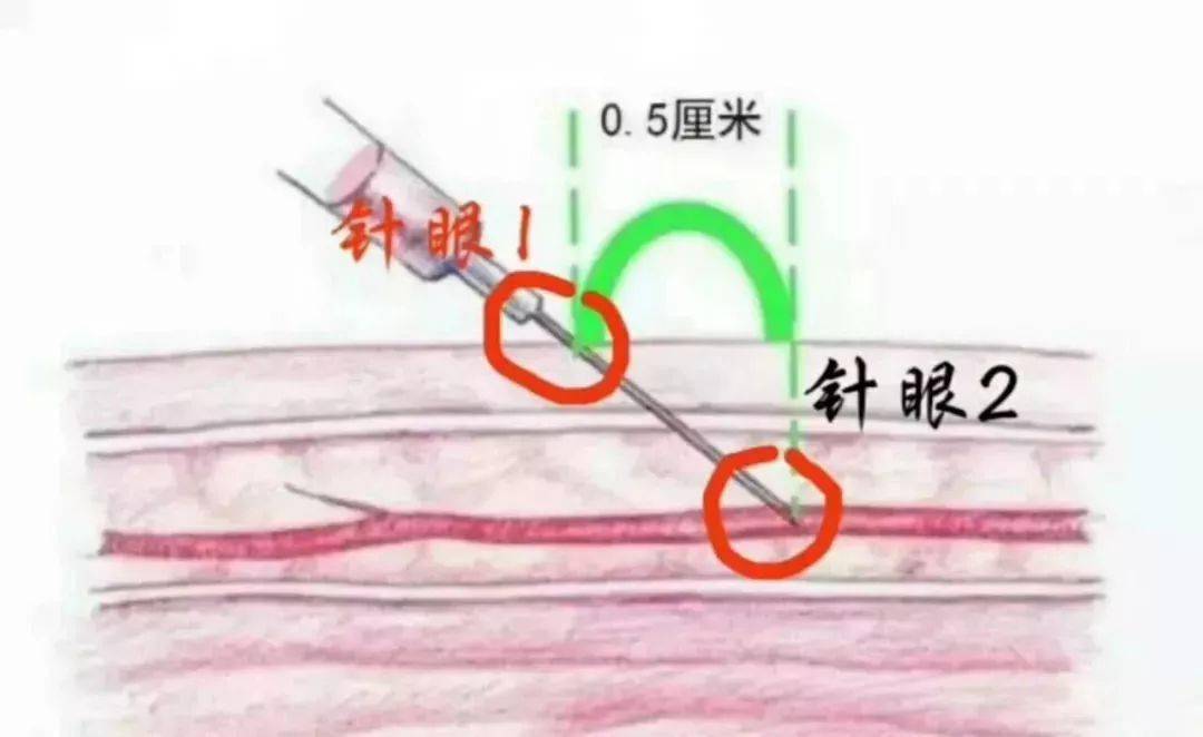 牛颈静脉采血部位图图片