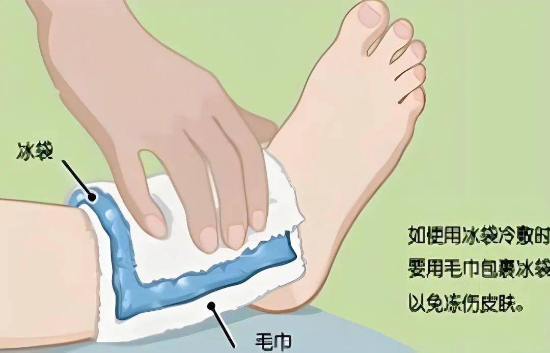 脚踝扭伤怎么办?这些治疗与康复手法请收藏→_训练_运动_活动