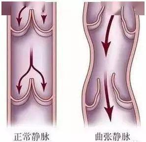 拉開身上的筋結,真是受益匪淺!_問題_五臟_動作