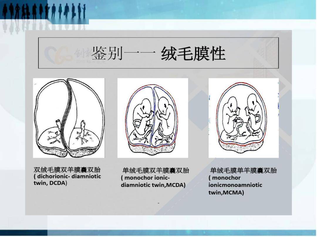 【ppt】雙胎剖宮產術後護理查房_國際_急救_專業